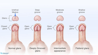 Glans descriptor